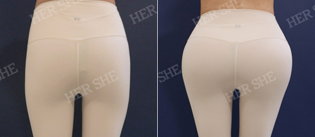 Butt Filler sebelum dan sesudah