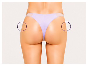 Memperbaiki Hip Dip yang Cekung