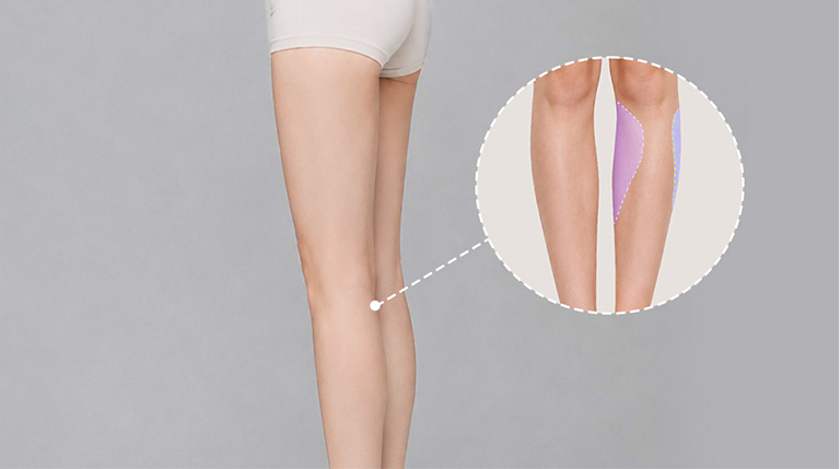 Desain Personal untuk Garis Kaki yang Seimbang